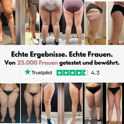 3D Anti-Cellulite-Leggings