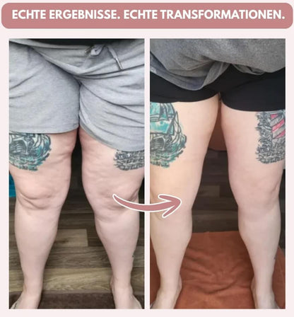 3D Anti-Cellulite-Leggings