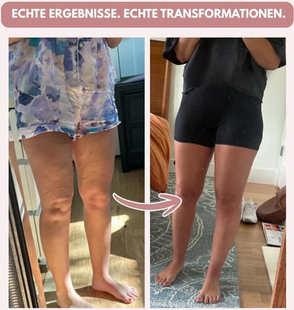 3D Anti-Cellulite-Leggings